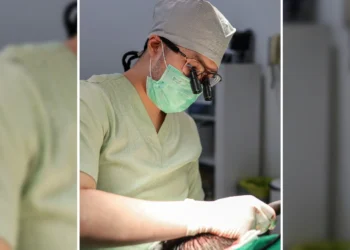 Transplantasi Rambut Kini Tak Perlu Cukur Plontos _Womanindonesia.co.id