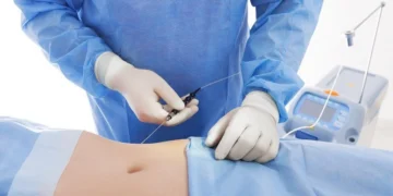 Laser-Assisted Liposuction: Bikin Lemak Hilang dan Kulit Kencang Sekaligus_womanindonesia.co.id