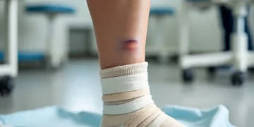 Cedera Engkel: Kenali Penyebab, Penanganan, dan Cara Mencegahnya_Womanindonesia.co.id