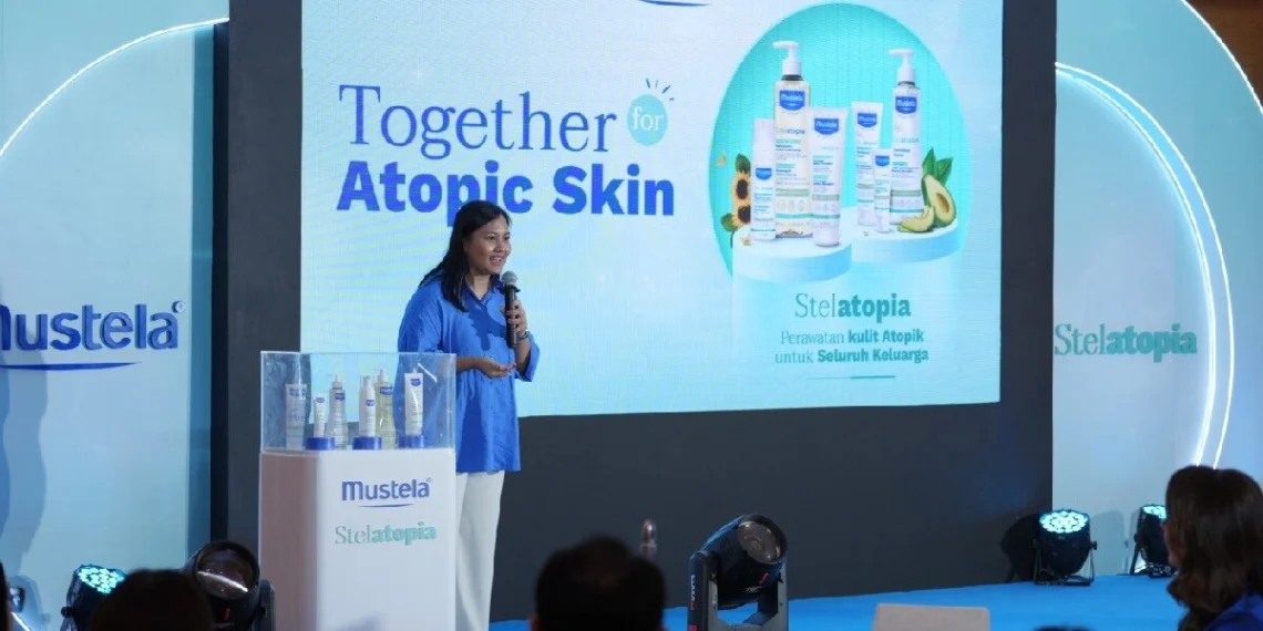 Kenali Dermatitis Atopik dan Cara Merawatnya dengan Tepat 1 Kenali Dermatitis Atopik dan Cara Merawatnya dengan Tepat_Womanindonesia.co.id